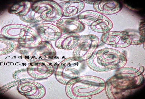 广州管圆线虫第3期幼虫