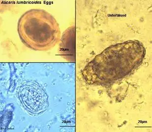 似蚓蛔线虫虫卵图片（受精、未受精）