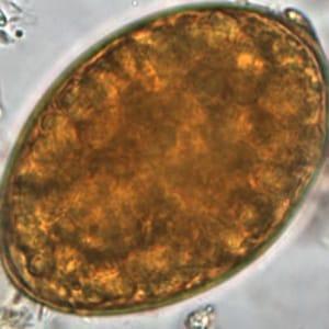 阔节裂头绦虫虫卵标本