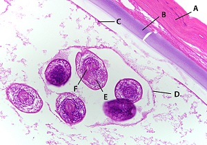细粒棘球绦虫成虫