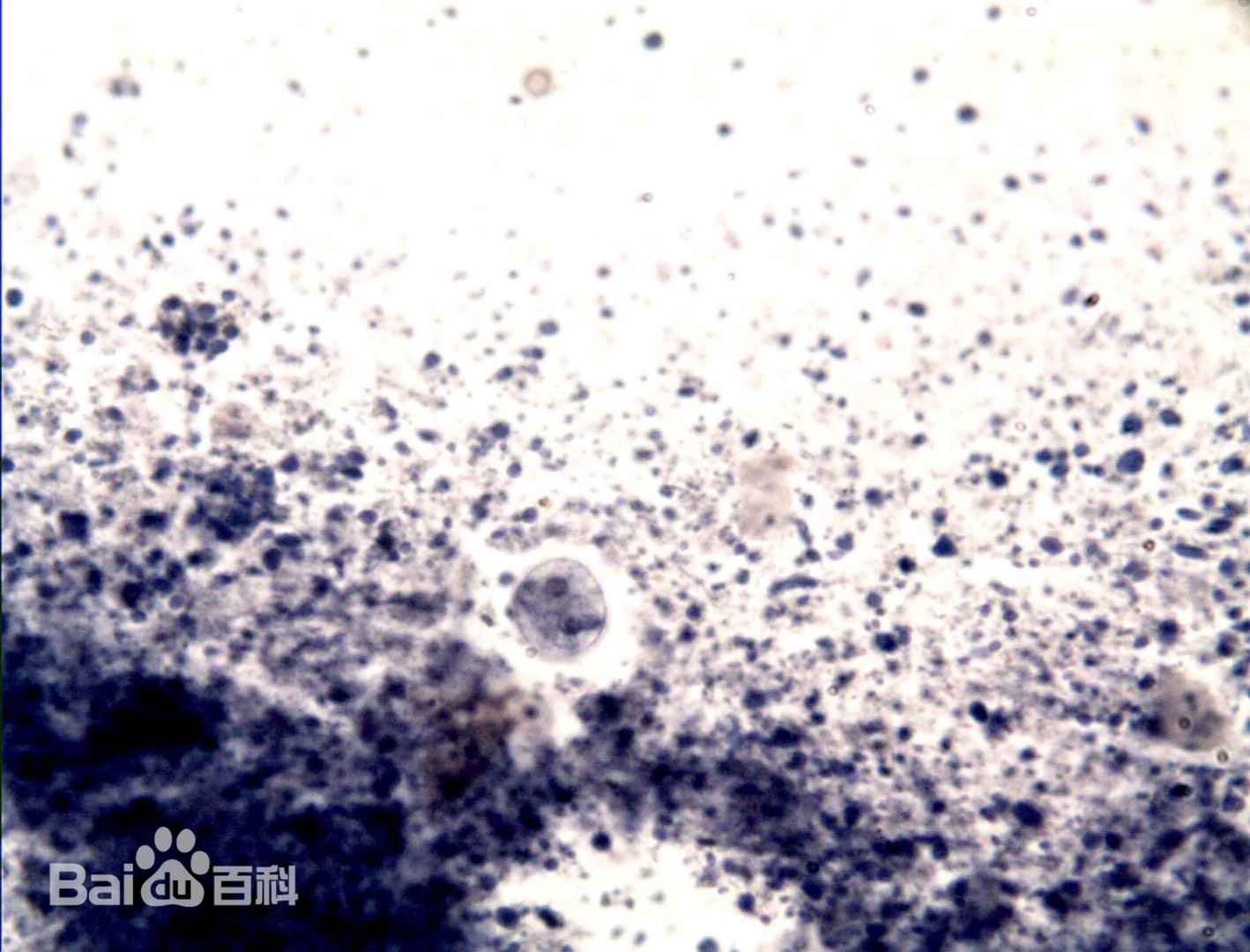 溶组织内阿米巴的两核包囊