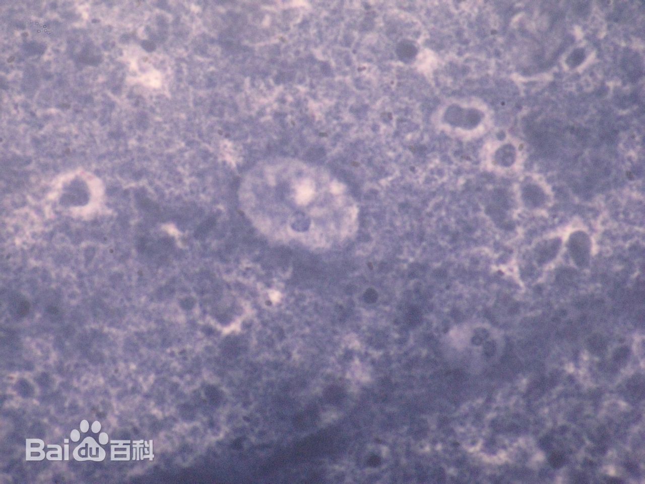 溶组织内阿米巴的滋养体