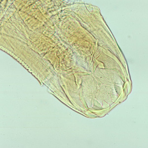 十二指肠钩口线虫成虫