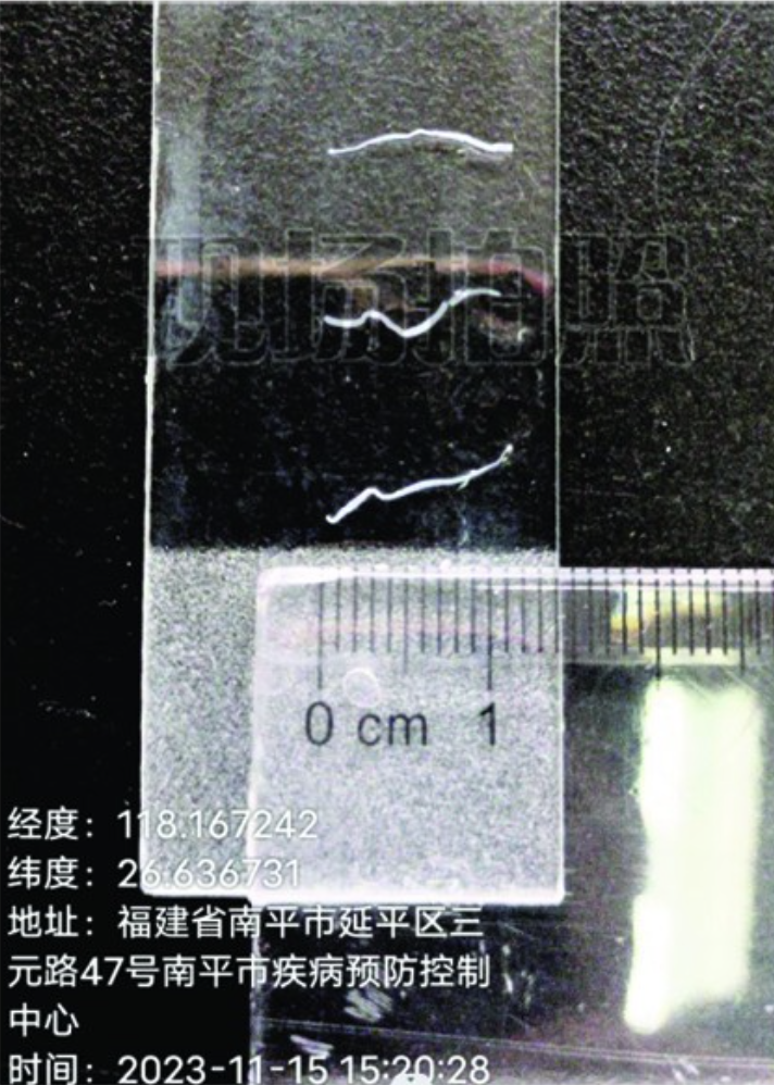 微小膜壳绦虫成虫