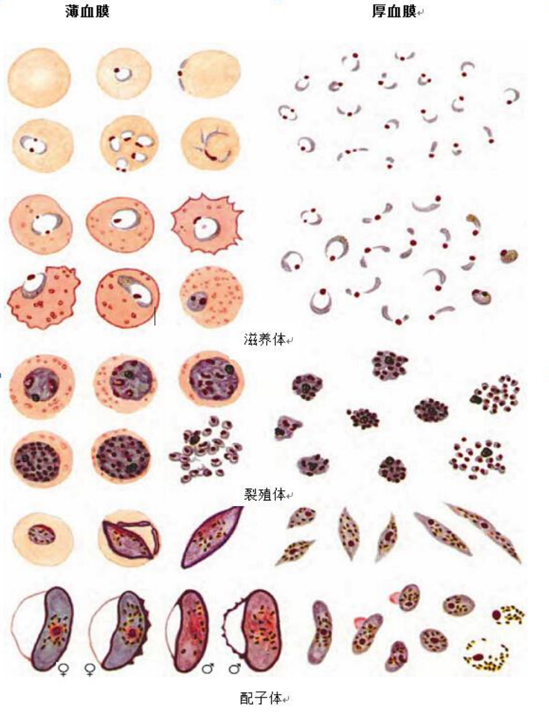 恶性疟原虫薄厚血膜形态图