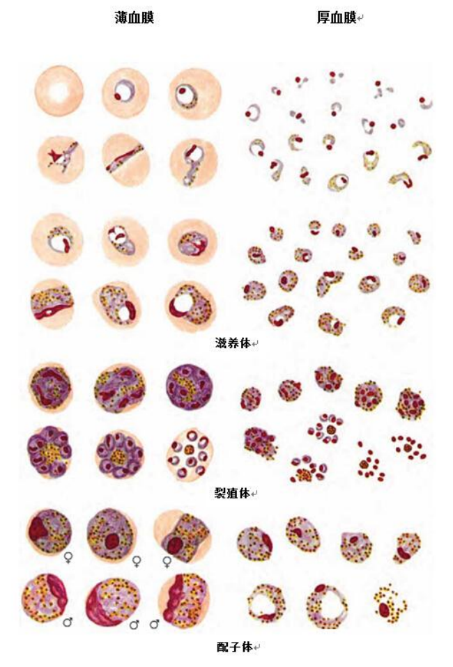 三日疟原虫薄厚血膜形态图