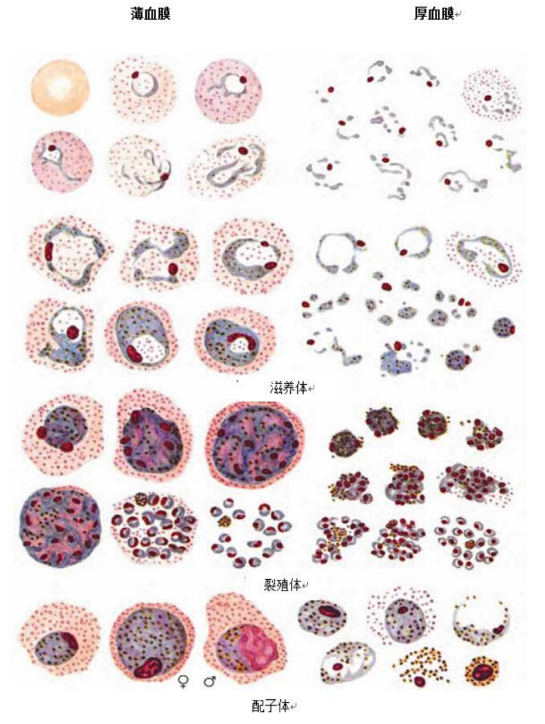 间日疟原虫薄厚血膜形态图