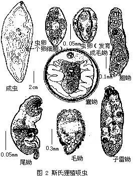 斯氏并殖吸虫示意图