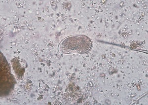 粪类圆线虫虫卵