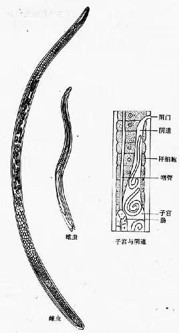 旋毛形线虫成虫